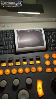 Dispositivo de ultrasonido para cl�nicas m�dicas Medison Sansung